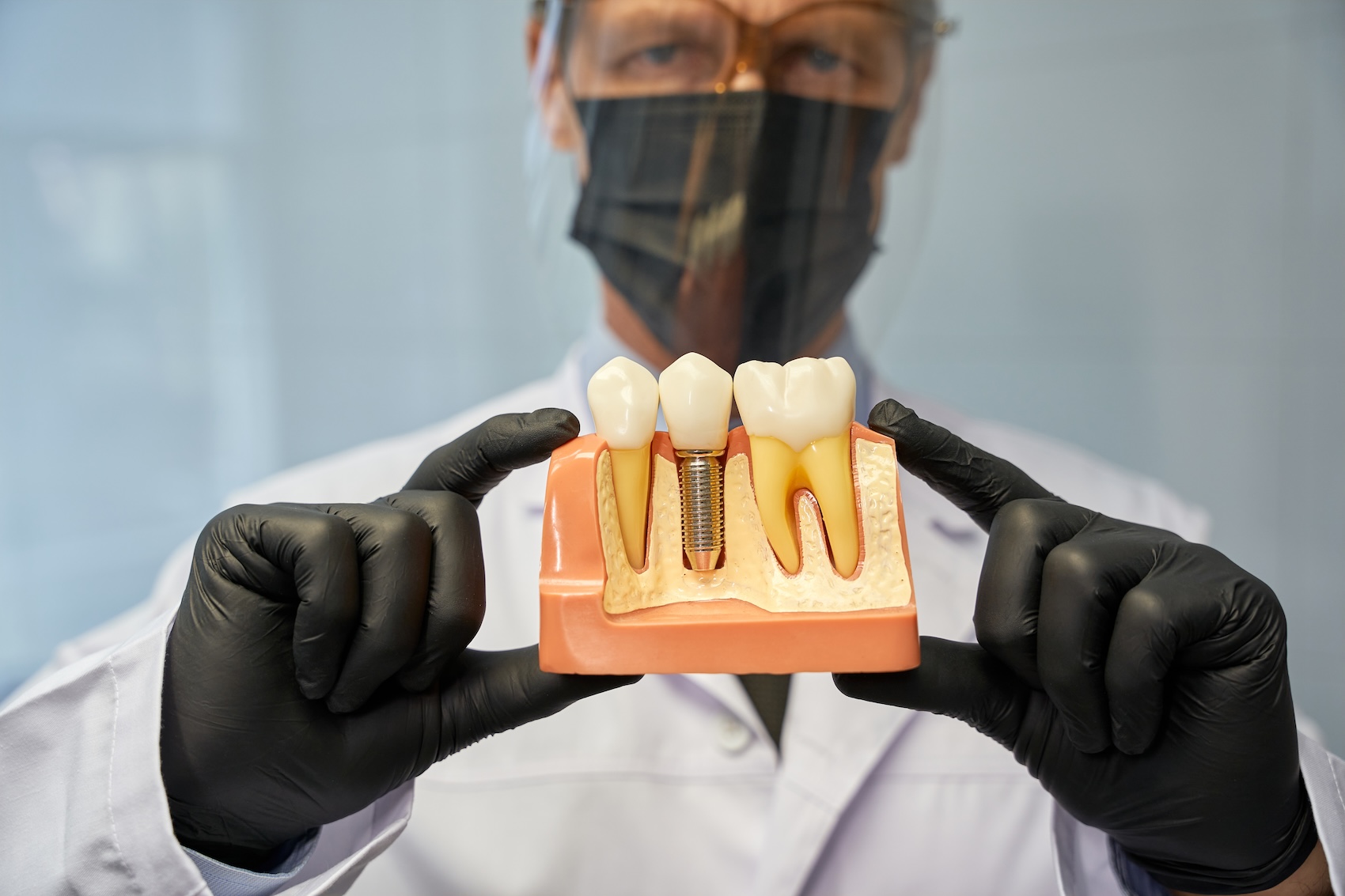 Wearing surgical gloves, a provider at the Krupp Center holds a plastic learning aid up in front of himself. This plastic model shows how dental implants near Hampton, MD, sit within the jawbone and alongside other natural teeth.