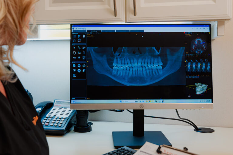 A computer displays X-rays of a patient's jaw and teeth in preparation for a dental extraction. Sometimes, your dentist near Pikesville needs X-rays to properly diagnose and perform an extraction.